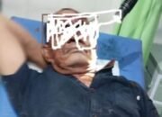 Maling Nekat Di Lamongan Babak Belur Dihajar Warga Usai Membekap Korban