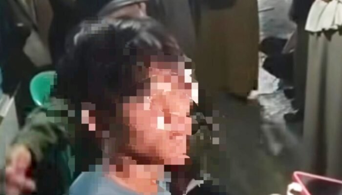 Kesaksian Fatur Usai Kericuhan Pejompongan Jakarta Pusat: Dipaksa Mengaku Provokator